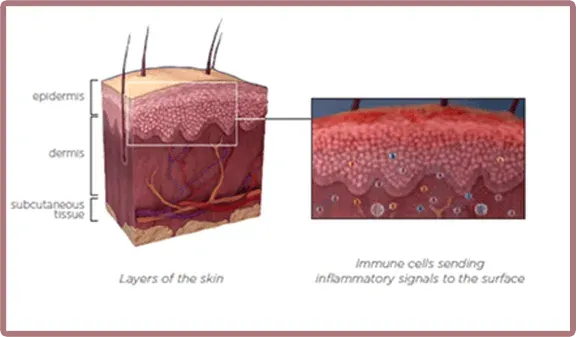 how the immune system sends inflammatory signals to the surface